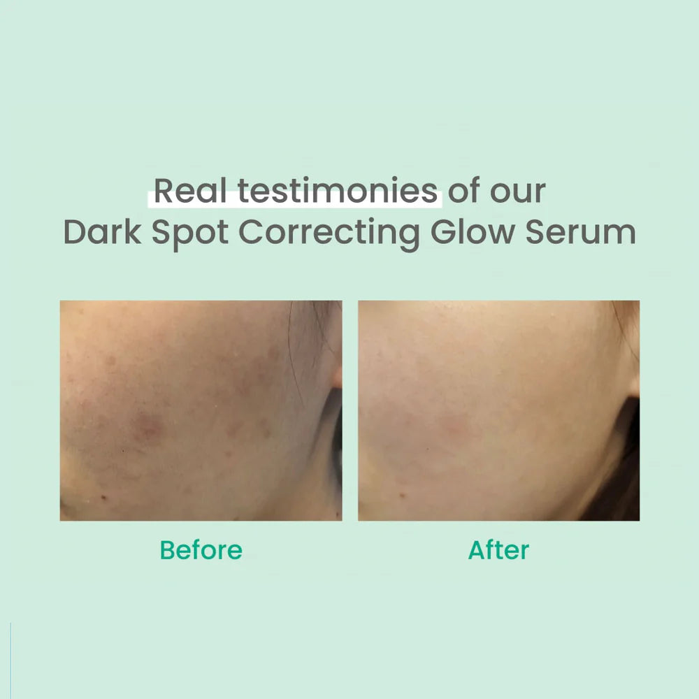 AXIS-Y Dark Spot Correcting Glow Serum